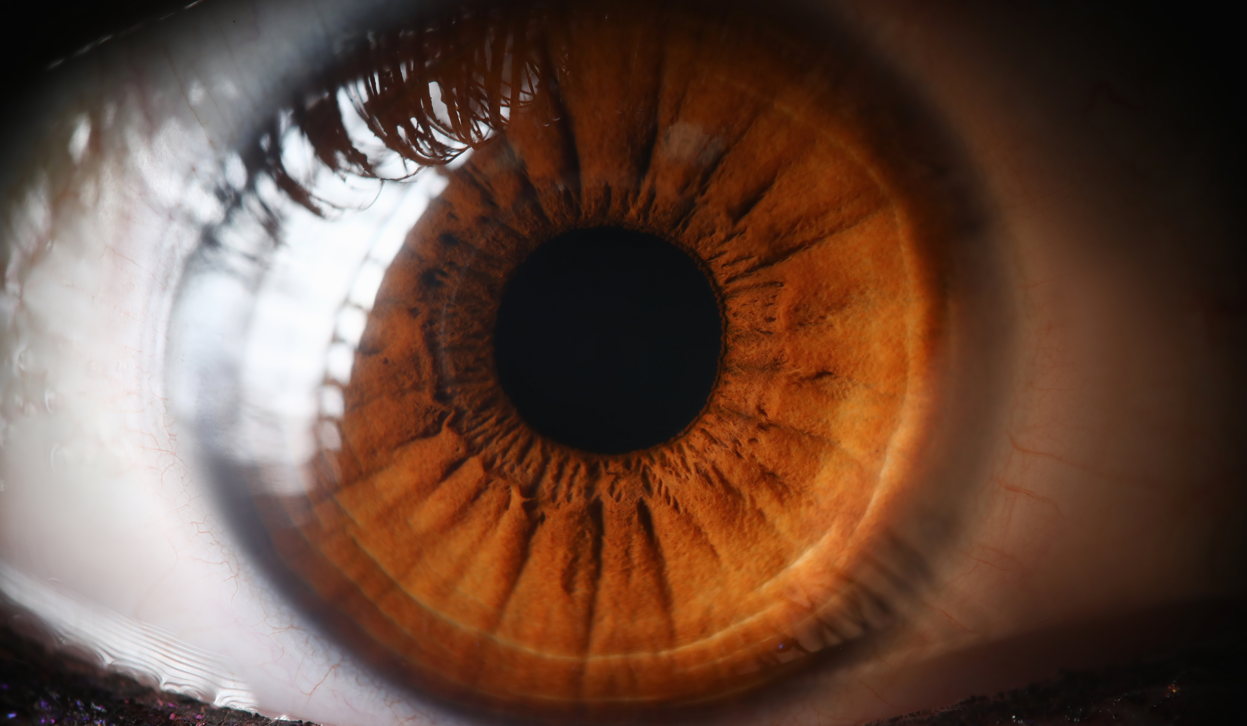 picture of an eye