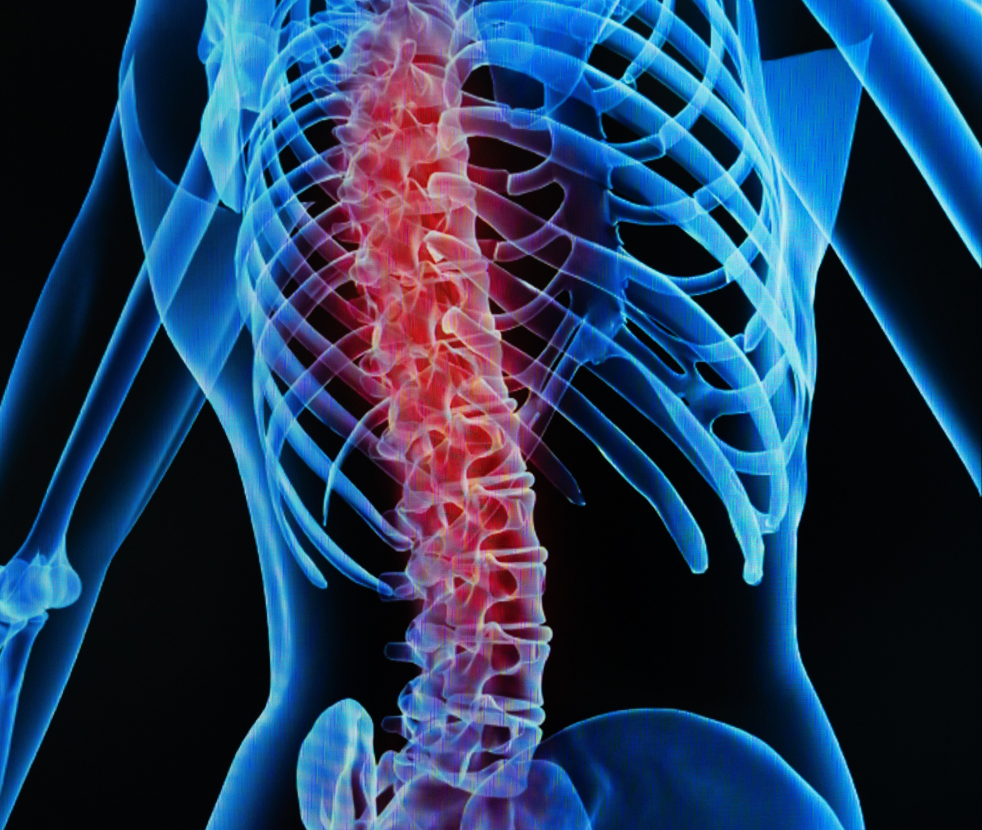 image of a spine