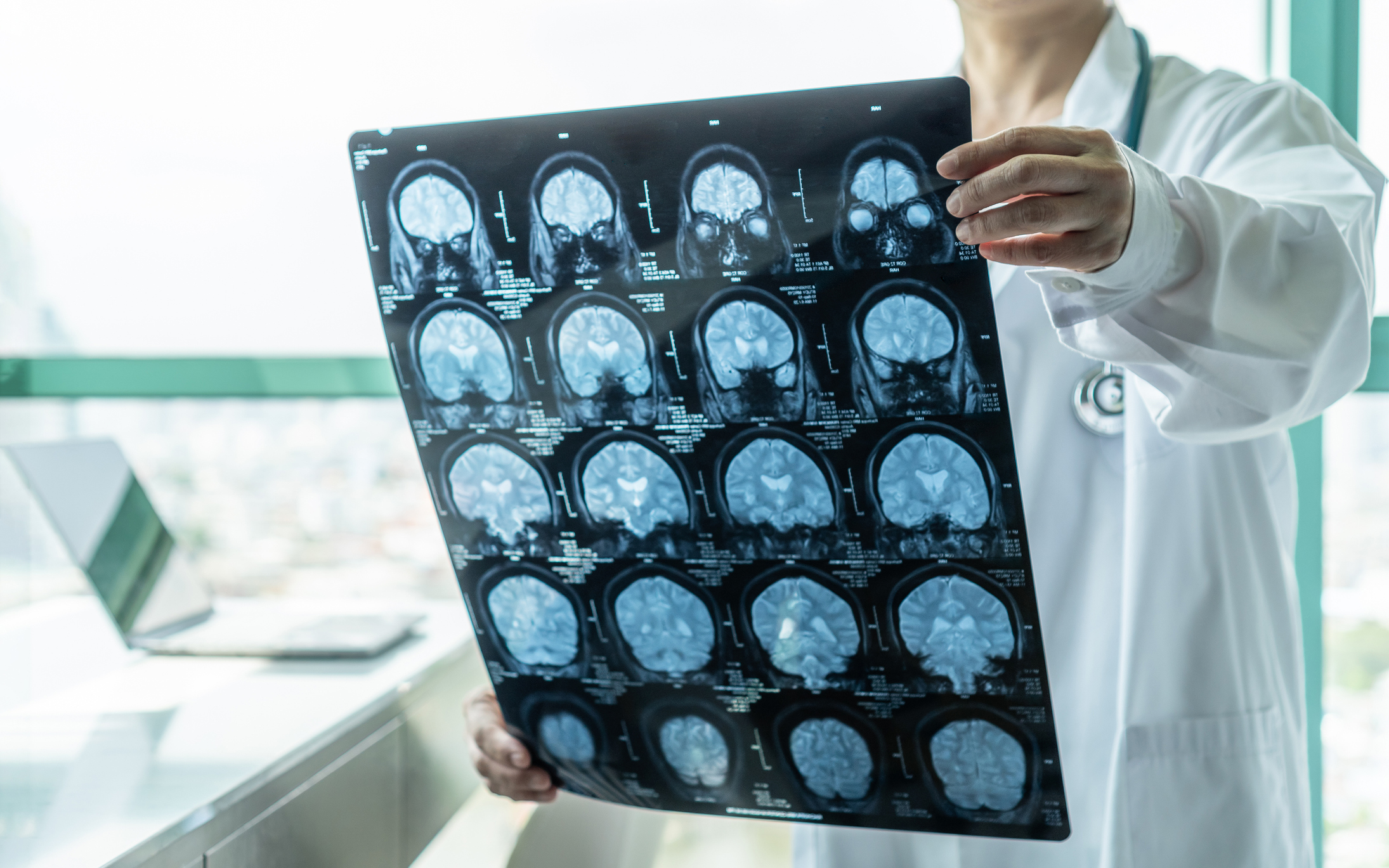 a person in a white coat holding up a film from a brain scan