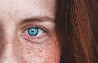 Image of a ginger hair women bright blue eyes with many freckles on her face.